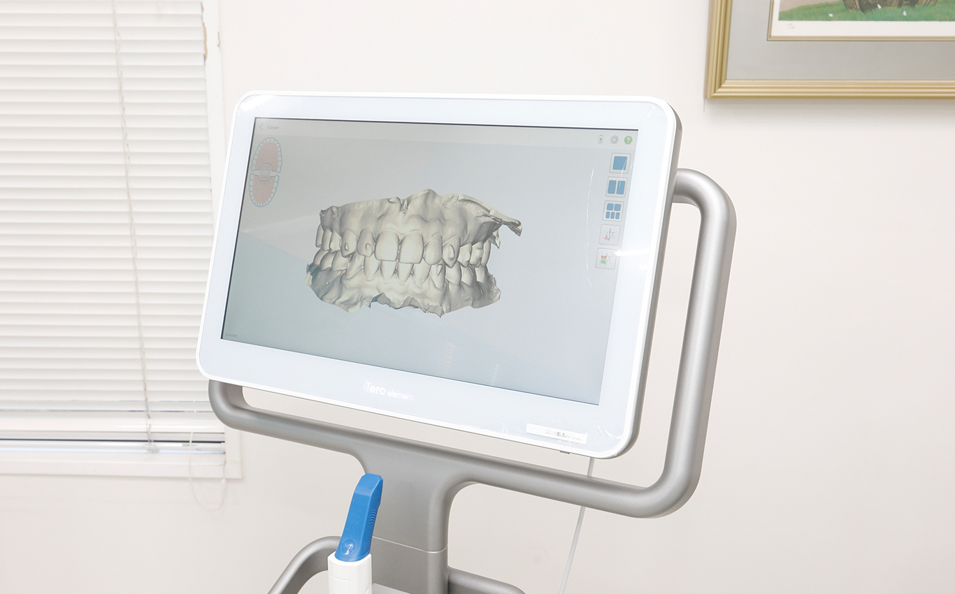 マウスピース型矯正歯科装置(インビザライン)